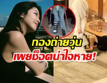 สุดห่วง! นางเอกดังสะดุดล้มหน้าคว่ำ ต้องใส่เฝือกอ่อน